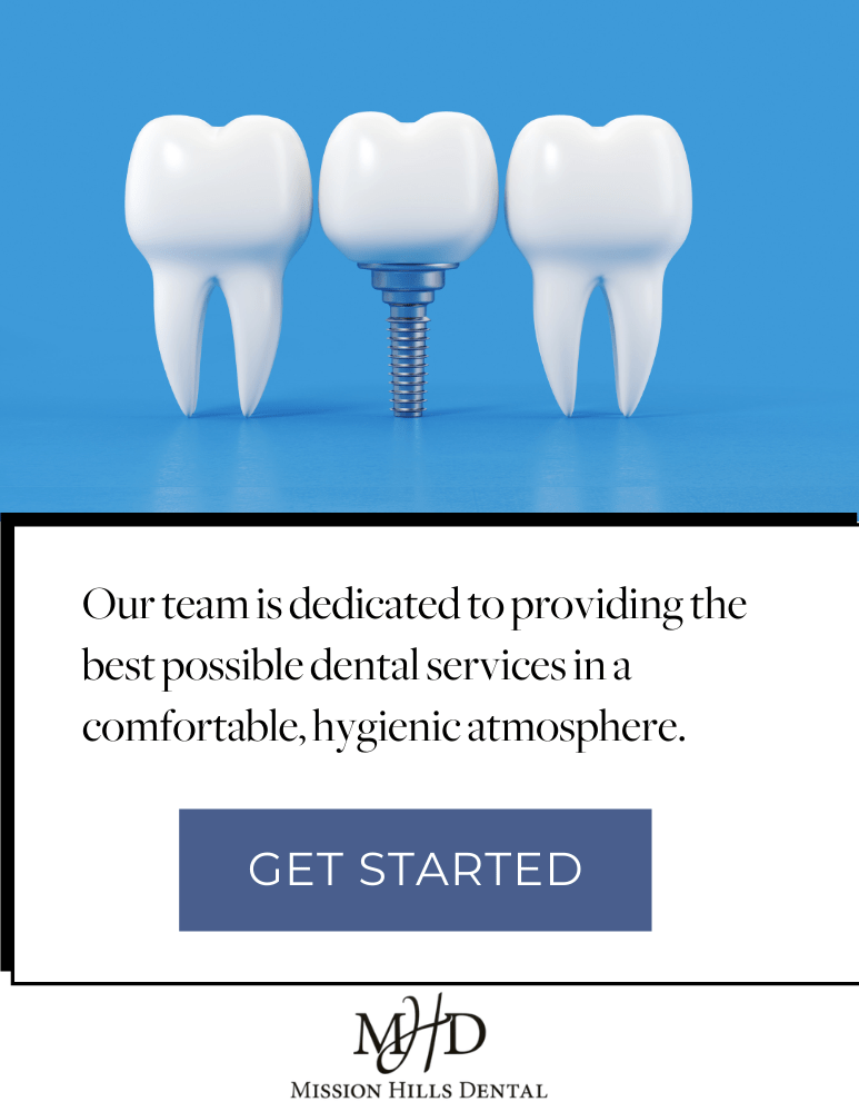 Dental Implants